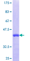 ab165313 on a 12.5% SDS-PAGE stained with Coomassie Blue.