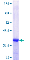 ab160668 on a 12.5% SDS-PAGE stained with Coomassie Blue.