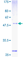 ab161293 on a 12.5% SDS-PAGE stained with Coomassie Blue.