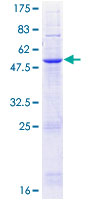 ab161387 on a 12.5% SDS-PAGE stained with Coomassie Blue.