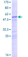 ab162458 on a 12.5% SDS-PAGE stained with Coomassie Blue.