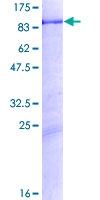 ab153087 on a 12.5% SDS-PAGE stained with Coomassie Blue.