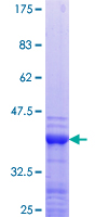 ab153088 on a 12.5% SDS-PAGE stained with Coomassie Blue.