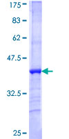 ab163295 on a 12.5% SDS-PAGE stained with Coomassie Blue.