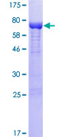 ab163823 on a 12.5% SDS-PAGE stained with Coomassie Blue.