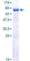 ab163215 on a 12.5% SDS-PAGE stained with Coomassie Blue.