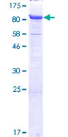 ab162630 on a 12.5% SDS-PAGE stained with Coomassie Blue.