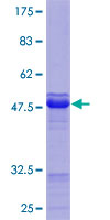 ab162631 on a 12.5% SDS-PAGE stained with Coomassie Blue.
