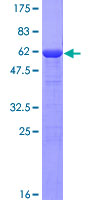 ab164936 on a 12.5% SDS-PAGE stained with Coomassie Blue.