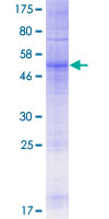 ab165158 on a 12.5% SDS-PAGE stained with Coomassie Blue.
