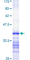 ab164480 on a 12.5% SDS-PAGE stained with Coomassie Blue.