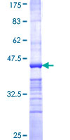 ab164481 on a 12.5% SDS-PAGE stained with Coomassie Blue.