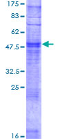ab165297 on a 12.5% SDS-PAGE stained with Coomassie Blue.