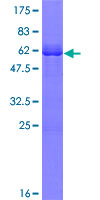 ab165797 on a 12.5% SDS-PAGE stained with Coomassie Blue.