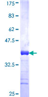 ab165139 on a 12.5% SDS-PAGE stained with Coomassie Blue.