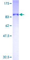 ab153049 on a 12.5% SDS-PAGE stained with Coomassie Blue.