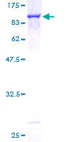 ab153050 on a 12.5% SDS-PAGE stained with Coomassie Blue.