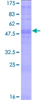 ab165173 on a 12.5% SDS-PAGE stained with Coomassie Blue.