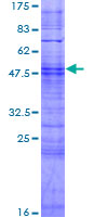 ab166108 on a 12.5% SDS-PAGE stained with Coomassie Blue.