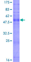ab165928 on a 12.5% SDS-PAGE stained with Coomassie Blue.