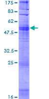 ab162008 on a 12.5% SDS-PAGE stained with Coomassie Blue.