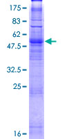 ab165930 on a 12.5% SDS-PAGE stained with Coomassie Blue.