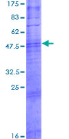 ab165296 on a 12.5% SDS-PAGE stained with Coomassie Blue.