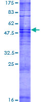 ab165298 on a 12.5% SDS-PAGE stained with Coomassie Blue.