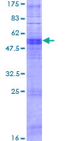 ab162005 on a 12.5% SDS-PAGE stained with Coomassie Blue.