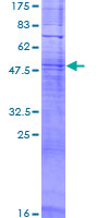 ab166470 on a 12.5% SDS-PAGE stained with Coomassie Blue.