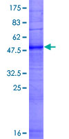 ab164363 on a 12.5% SDS-PAGE stained with Coomassie Blue.