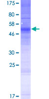 ab166225 on a 12.5% SDS-PAGE stained with Coomassie Blue.