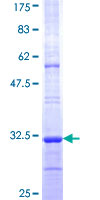 ab166226 on a 12.5% SDS-PAGE stained with Coomassie Blue.