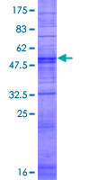 ab165266 on a 12.5% SDS-PAGE stained with Coomassie Blue.