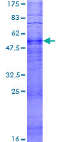 ab166551 on a 12.5% SDS-PAGE stained with Coomassie Blue.