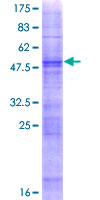 ab164032 on a 12.5% SDS-PAGE stained with Coomassie Blue.