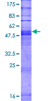 ab166458 on a 12.5% SDS-PAGE stained with Coomassie Blue.