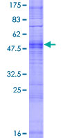 ab165188 on a 12.5% SDS-PAGE stained with Coomassie Blue.
