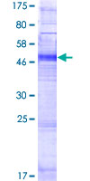 ab166457 on a 12.5% SDS-PAGE stained with Coomassie Blue.