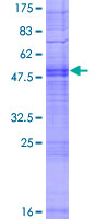 ab164016 on a 12.5% SDS-PAGE stained with Coomassie Blue.
