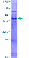 ab166462 on a 12.5% SDS-PAGE stained with Coomassie Blue.