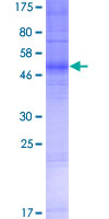ab166456 on a 12.5% SDS-PAGE stained with Coomassie Blue.