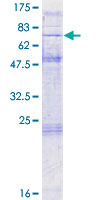 ab165914 on a 12.5% SDS-PAGE stained with Coomassie Blue.