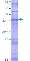 ab166441 on a 12.5% SDS-PAGE stained with Coomassie Blue.