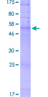 ab164017 on a 12.5% SDS-PAGE stained with Coomassie Blue.