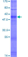 ab166433 on a 12.5% SDS-PAGE stained with Coomassie Blue.