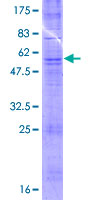 ab161676 on a 12.5% SDS-PAGE stained with Coomassie Blue.