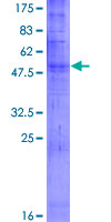 ab165157 on a 12.5% SDS-PAGE stained with Coomassie Blue.