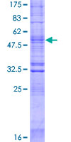 ab166437 on a 12.5% SDS-PAGE stained with Coomassie Blue.