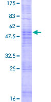 ab166449 on a 12.5% SDS-PAGE stained with Coomassie Blue.